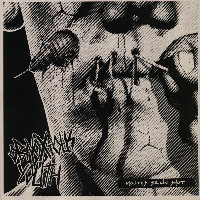 Obnoxious Youth Mouths Sewn Shut