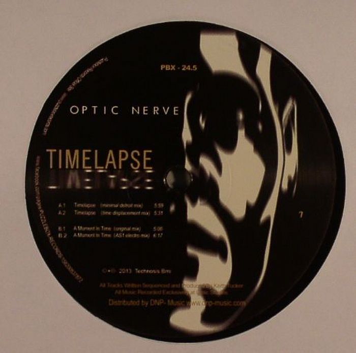 Optic Nerve Time Lapse