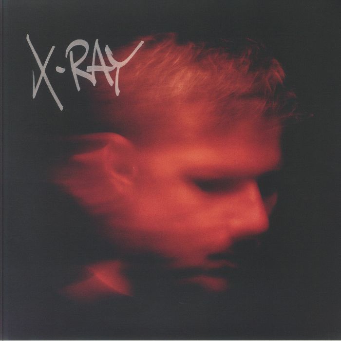 Murdock X Ray